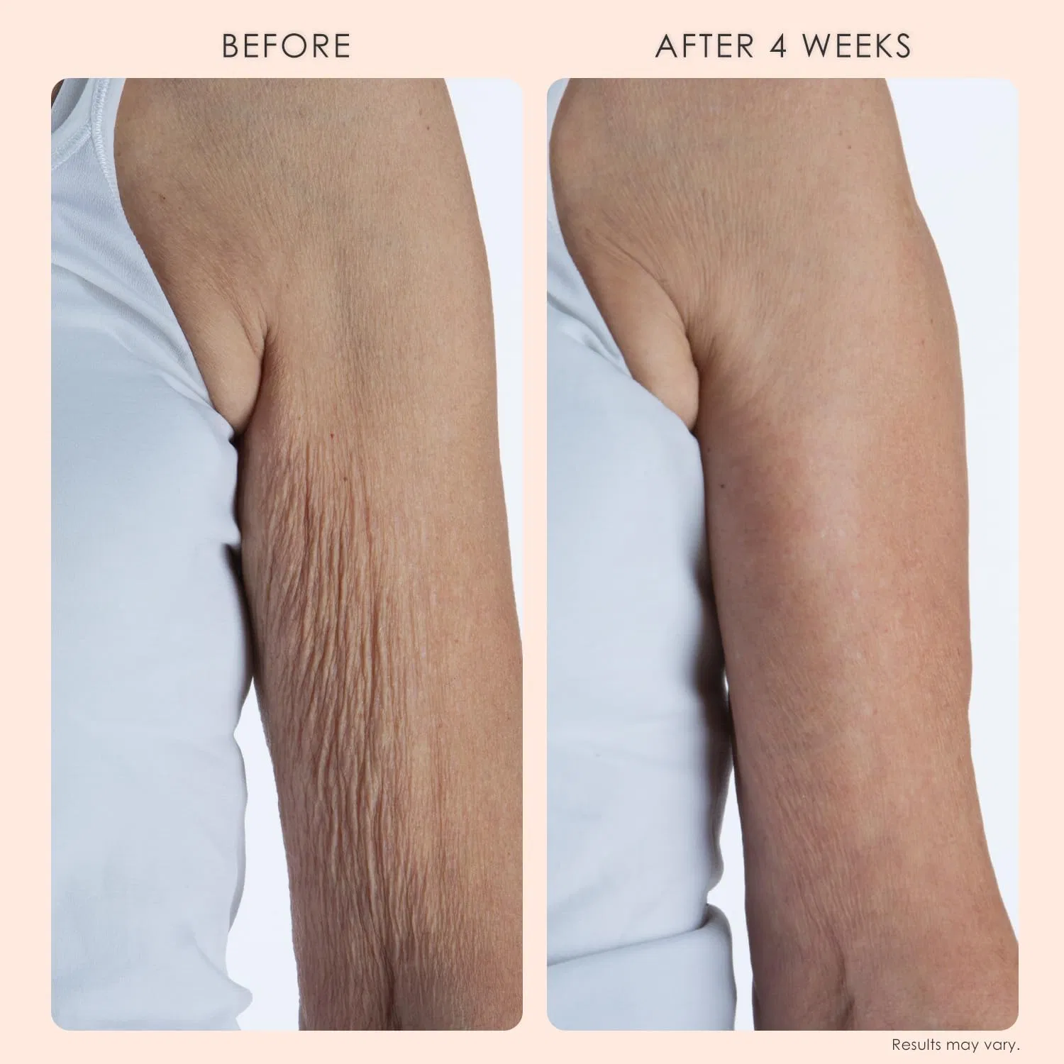 Крем для тела Crepe Erase Advanced Body Repair Treatment, BODY FIRM, 295 мл — фото 3