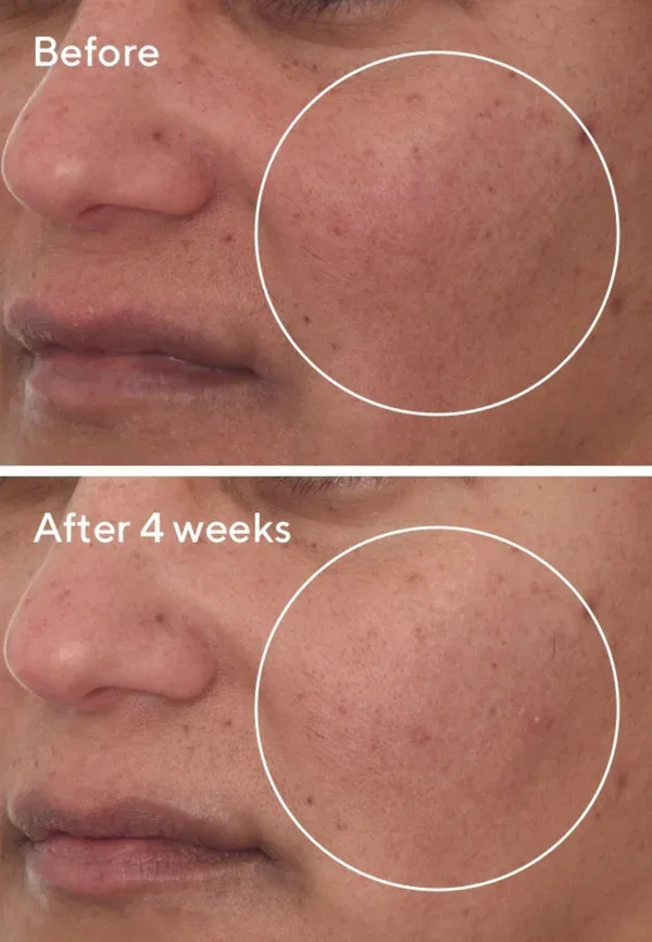 Сыворотка восстанавливающая Cellular Hydration Repair Serum, Murad, 15 мл — фото 2