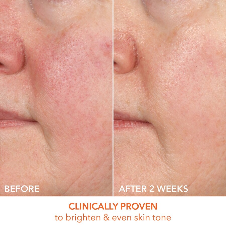 Сыворотка Dr. Dennis Gross Skincare — Для укрепления и осветления кожи с % молочной кислотой и витамином С, 30 мл — фото 4