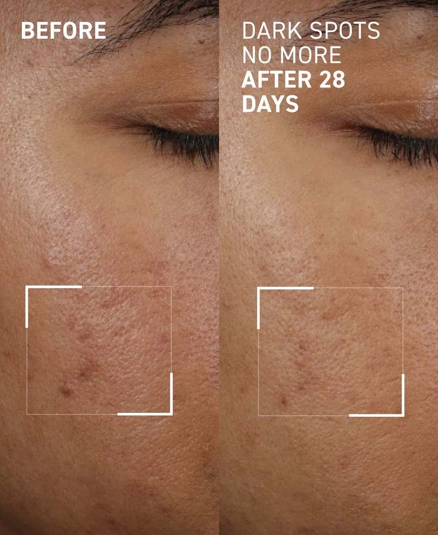 Сыворотка Dr. Brandt — Концентрат для уменьшения пигментных пятен Dark Spots No More Triple Acid — фото 3