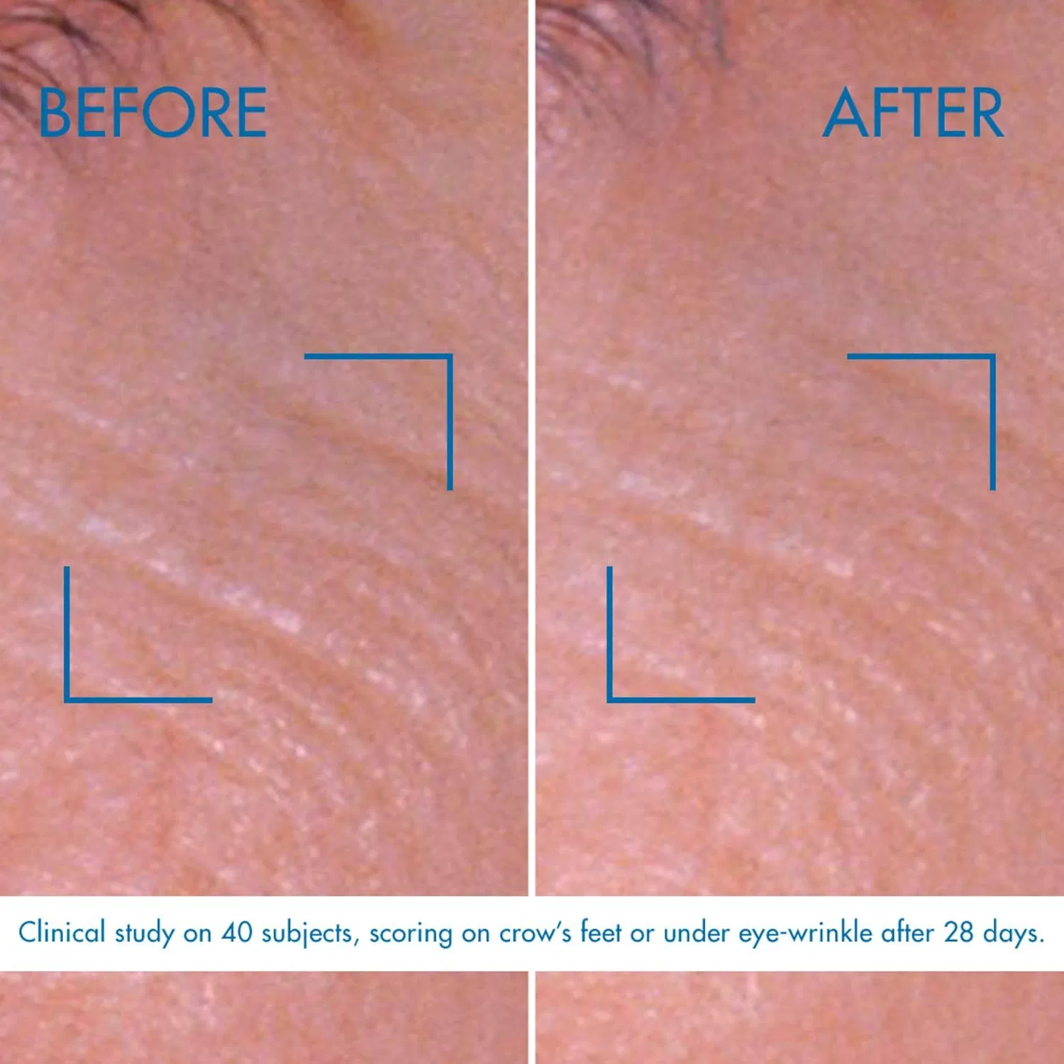 Крем для глаз с про-ретинолом «Pro-Retinol Eye Cream» от Biotherm Biotherm — фото 4
