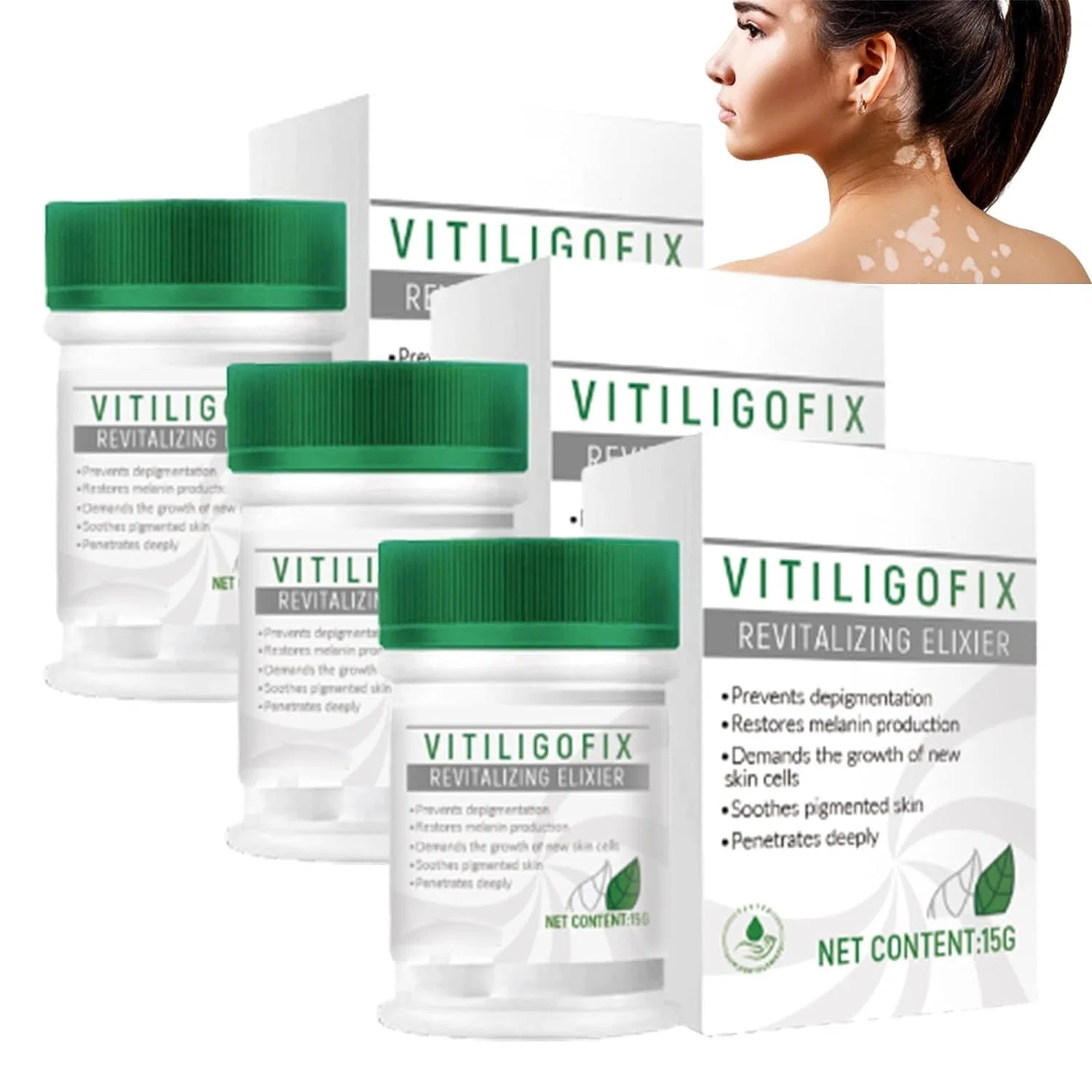 Крем для лица Ashopfun — Для лечения витилиго «Vitiligo Fix Revitalize Elixir» , 3 Pieces, 15 г