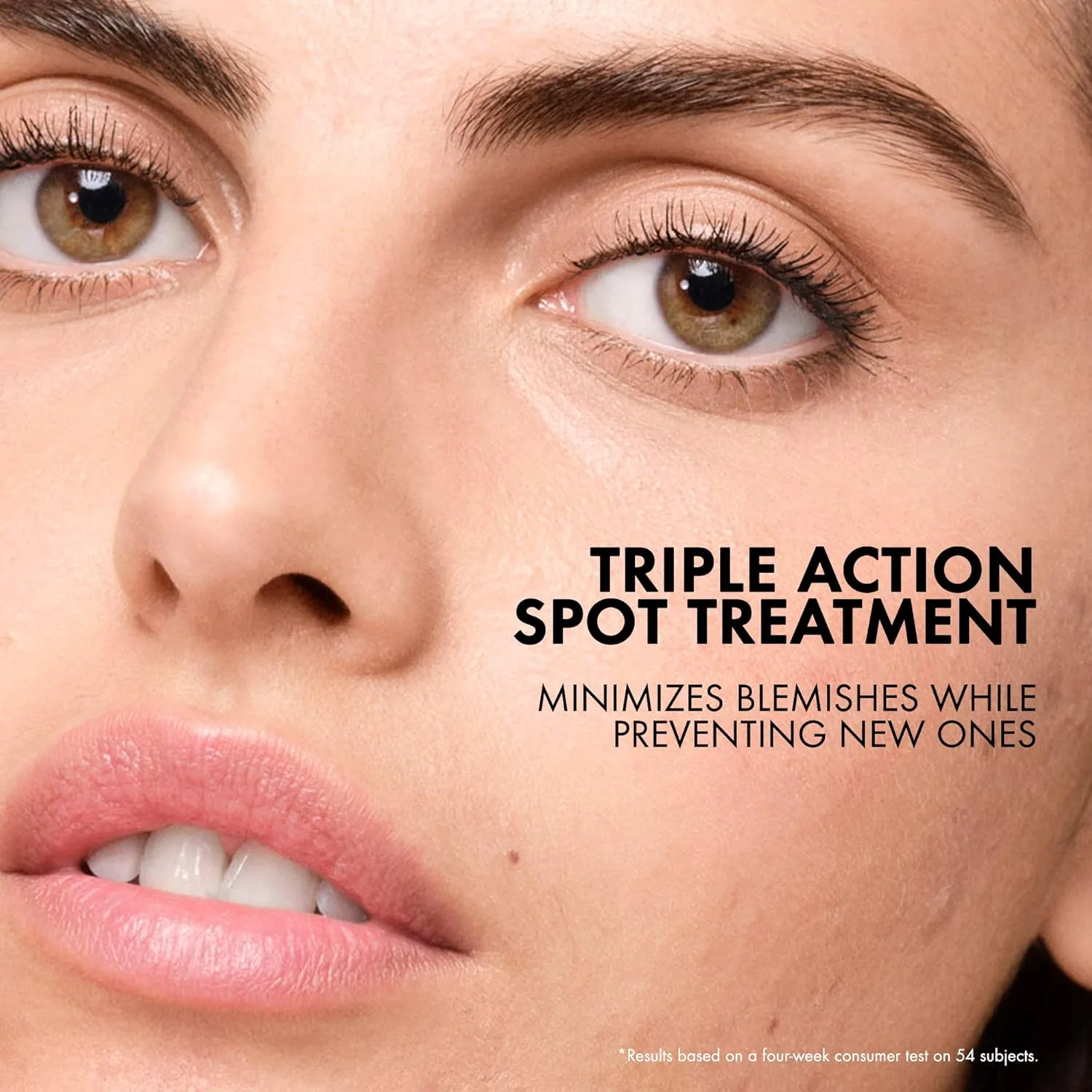 Пилинг Vichy — Normaderm SOS Acne Rescue Spot Corrector - средство для точечного лечения акне на лице с — фото 2
