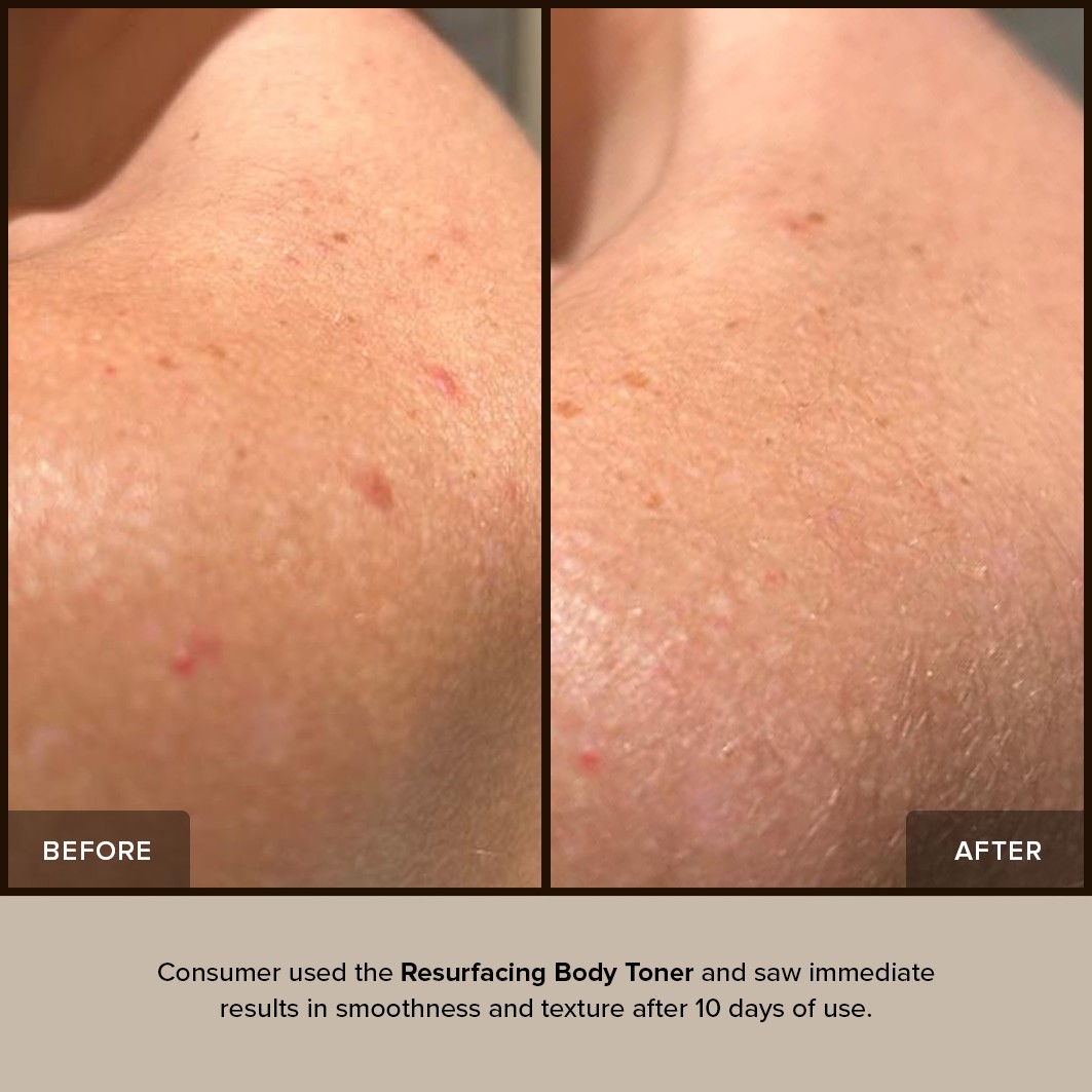 Спрей для тела resurfacing body toner Nudestix, объем 150 мл — фото 3