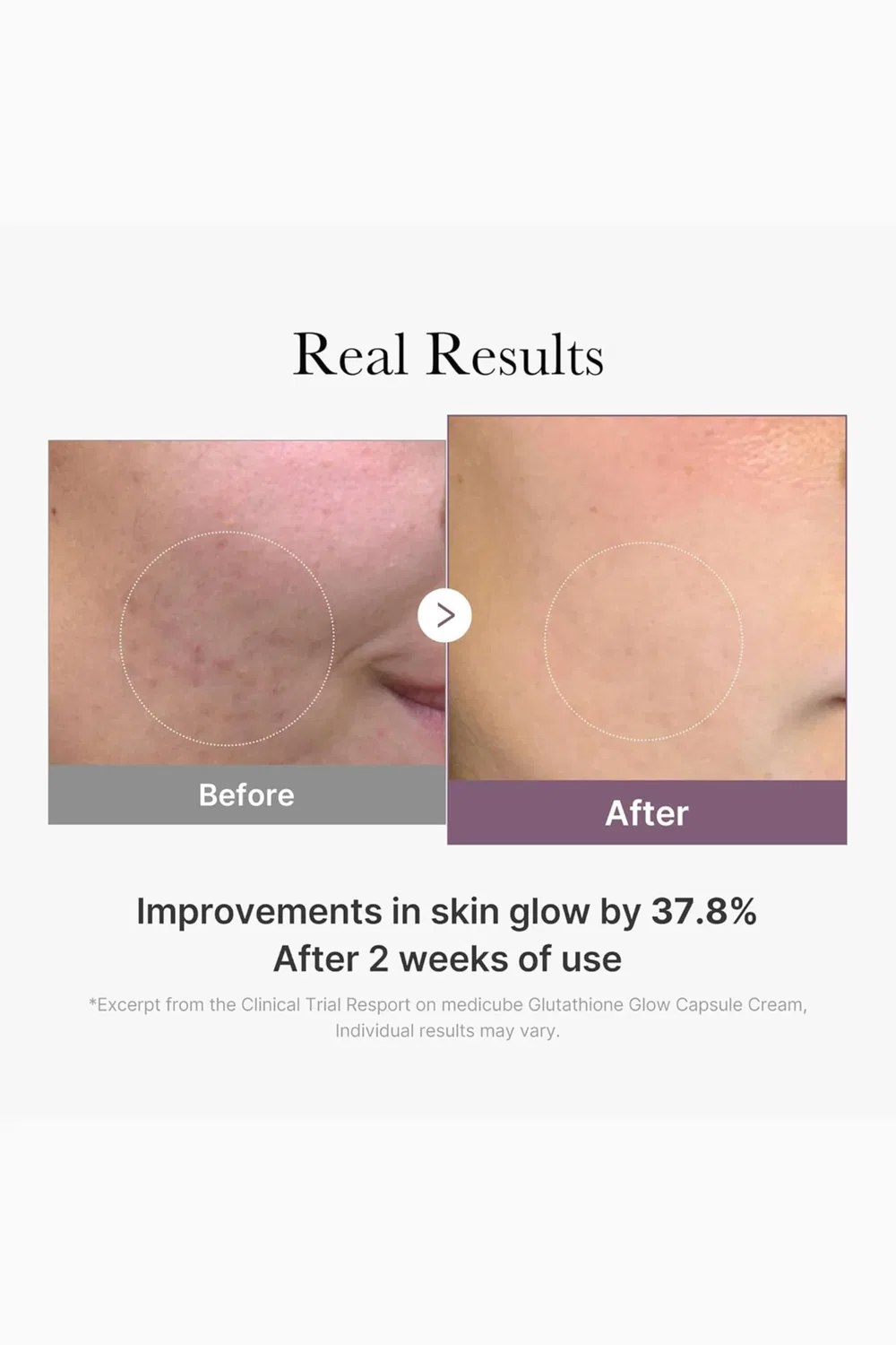 Крем для лица увлажняющий AGE-R Glutathione Glow Capsule Medicube — фото 4