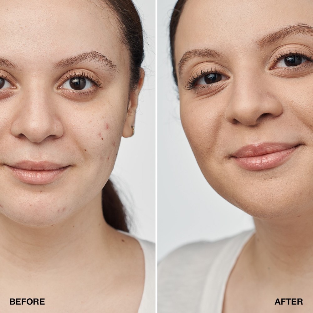 Тональный крем Even better clinical serum foundation spf 20 Clinique, cn52 neutral, 30 мл — фото 3