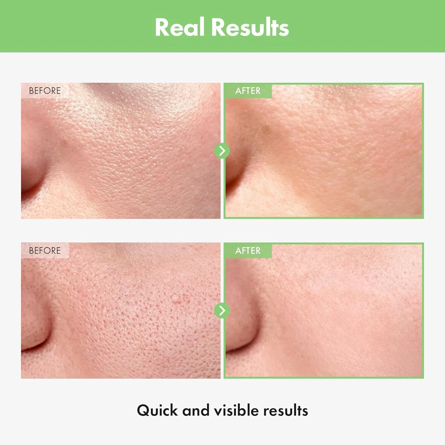 Сыворотка Tosowoong — Ампула для сужения пор «Green Tomato Pore Ampoule» от — фото 3