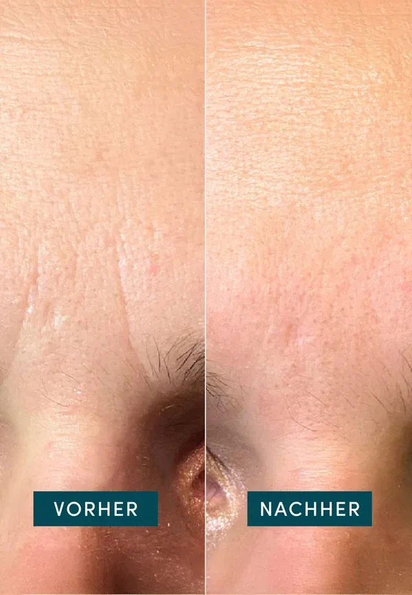 Патчи для лица с эктоином - тканевая маска 30 г Apricot Beauty — фото 3