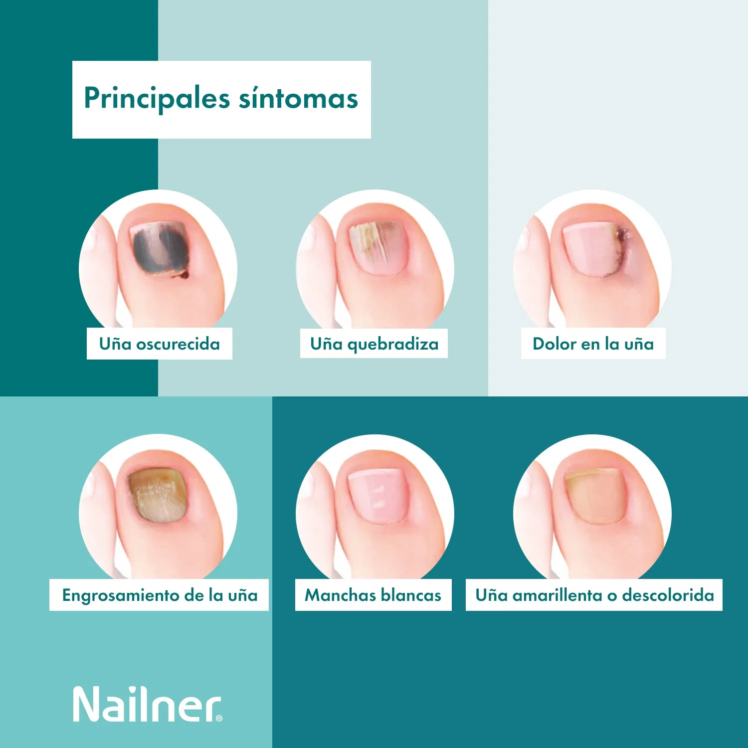 Карандаш для ногтей «Lápiz Anti-hongos Uñas 2 en 1» 4 мл от NAILNER Nailner — фото 3