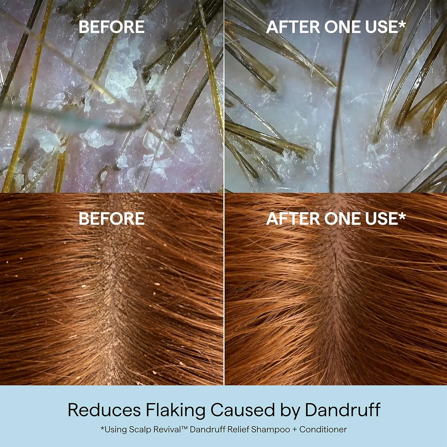 Briogeo Scalp Revival кондиционер против перхоти с древесным углем и 1, 8% салициловой кислоты, 250 мл — фото 3