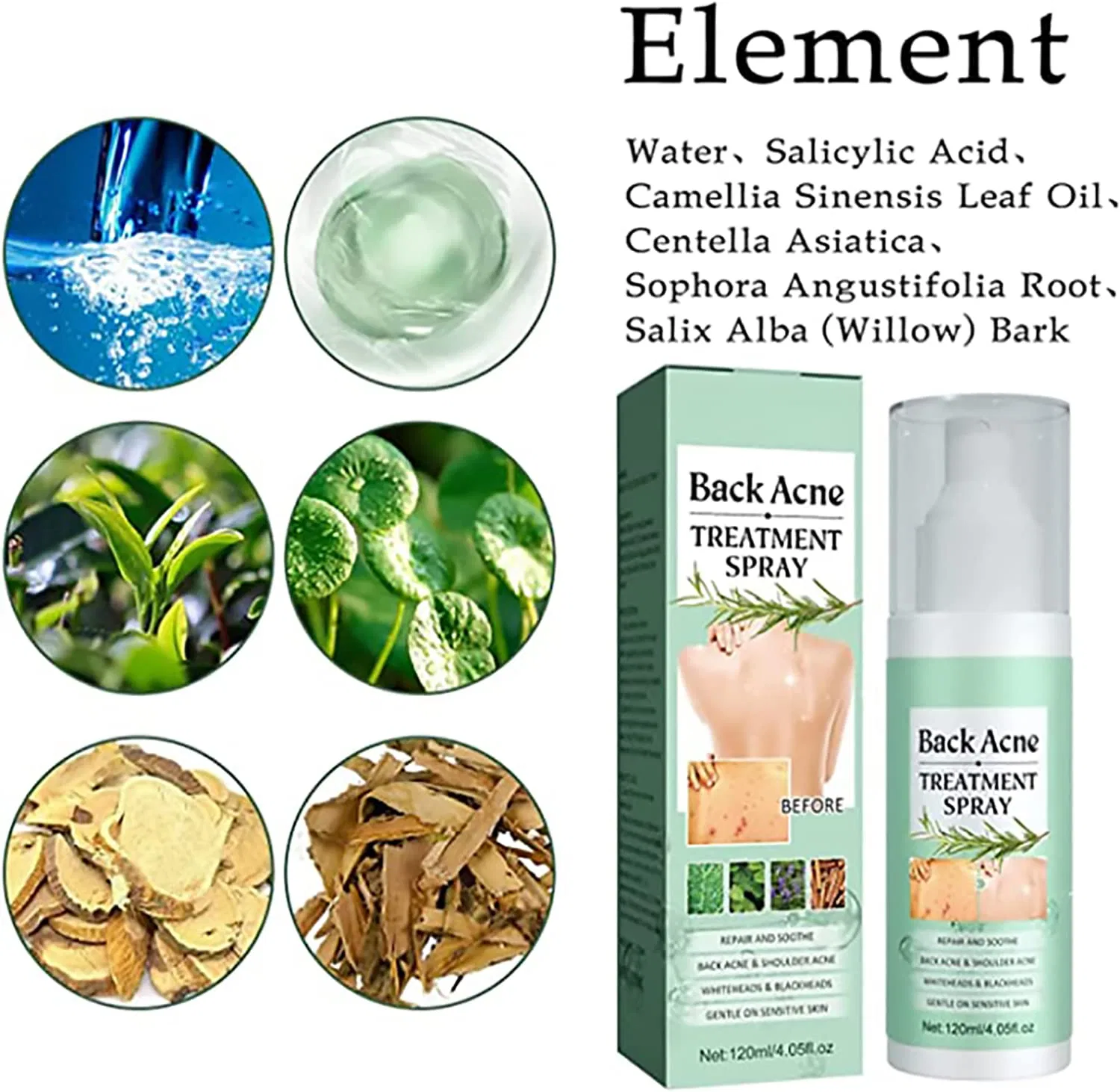 Спрей для лечения акне на спине Toxiklenz Back Acne Treatment Spray, 120 мл (3 шт.) ‎Sovtay, 3 Pieces. — фото 4