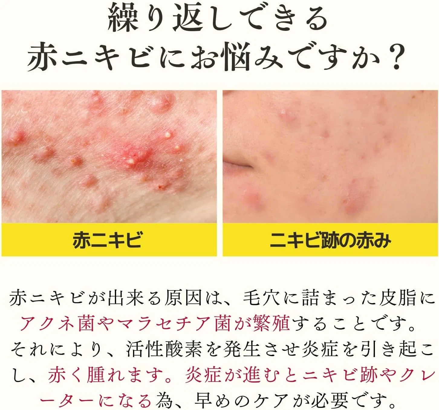 Лосьон для лица Dr. Re9 Berlian Acne Care VC Lotion, 80 мл — фото 2