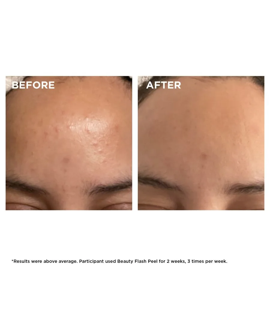 Пилинг Clarins — Экспресс- Beauty Flash Peel с BHA и AHA кислотами — фото 3