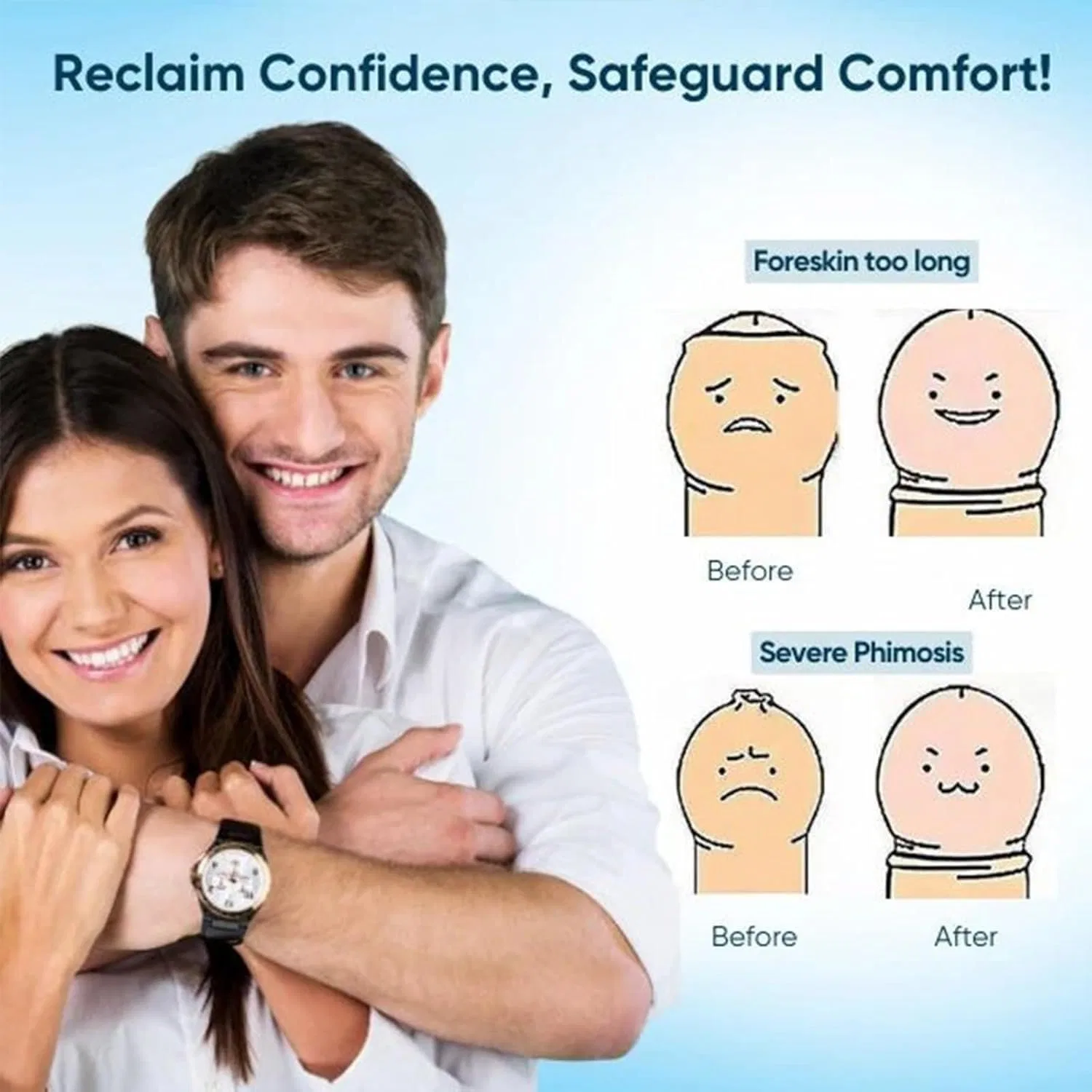 Крем для коррекции фимоза, Generisch, 20 г