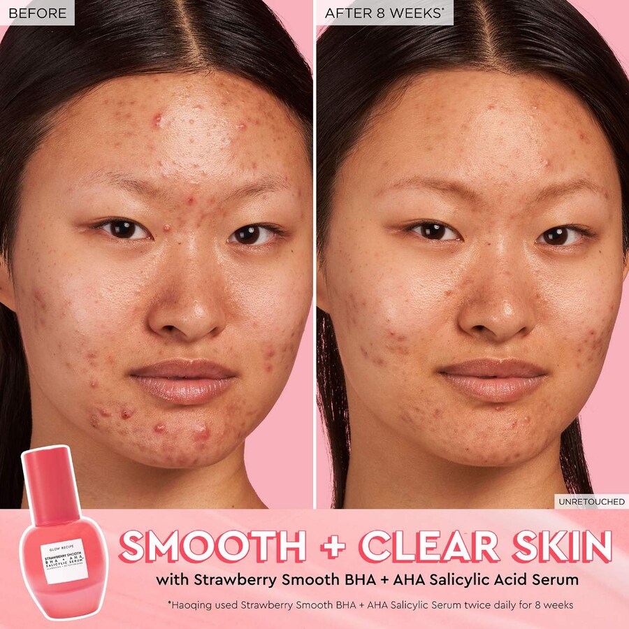 Сыворотка Glow Recipe — Strawberry Smooth с BHA + AHA салициловой кислотой, 30 мл — фото 3