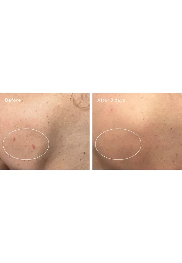 Боди-бальзам с салициловой кислотой Retexturizing Body Pads Murad 180 мл — фото 3