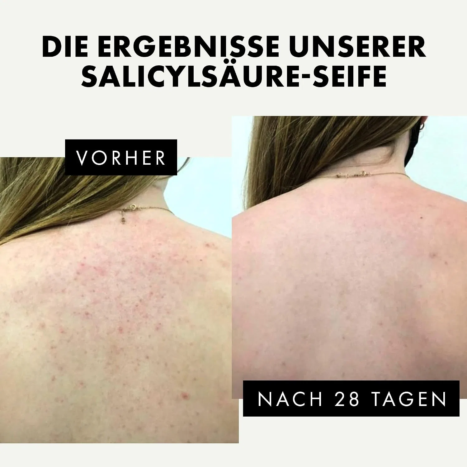 Мыло для лица с салициловой кислотой 2% Eclat Skincare, 60 г — фото 3
