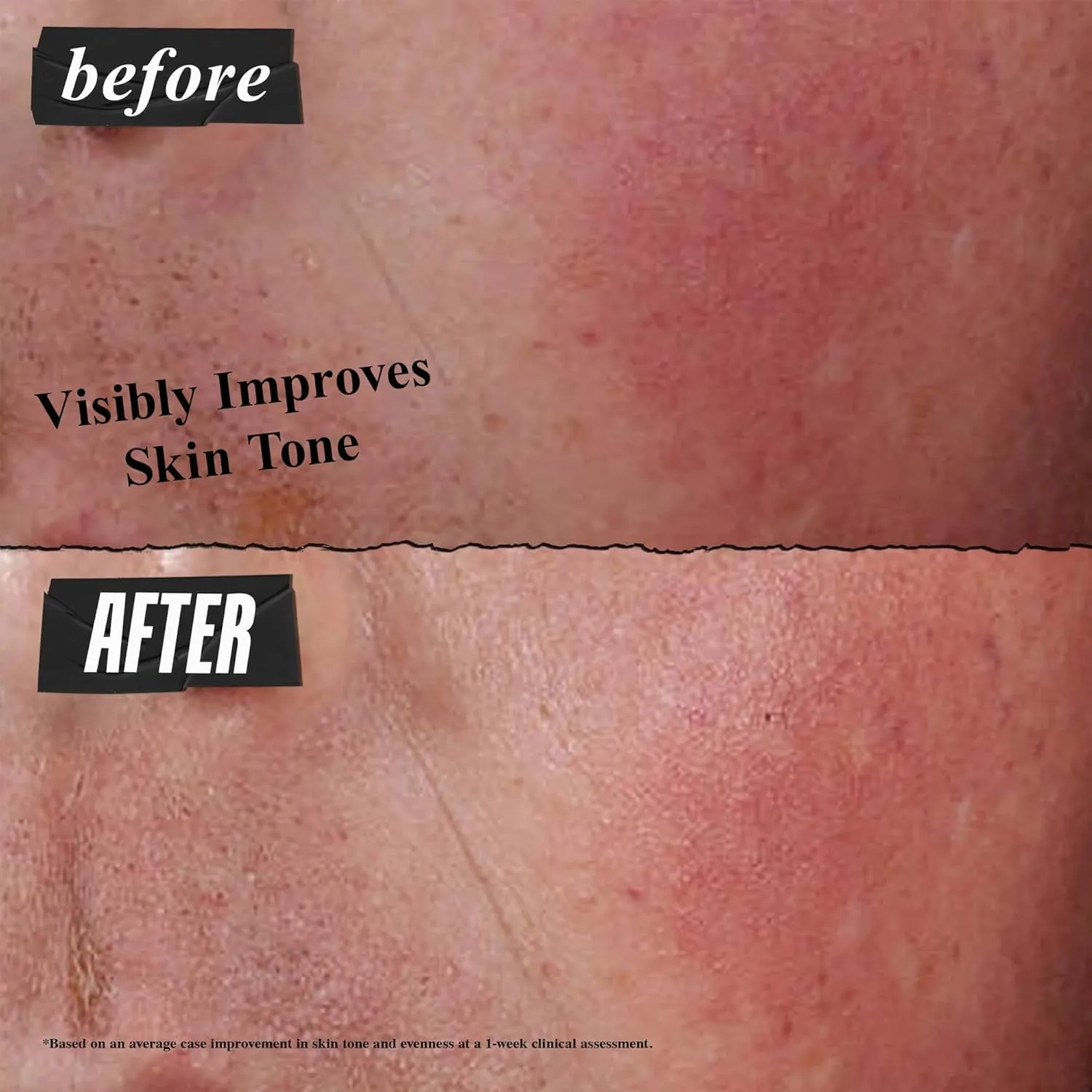 Крем для лица Kiehl's — Ultra Facial Advanced Repair Barrier Cream, интенсивное лечение для сухой и, 50 мл — фото 4