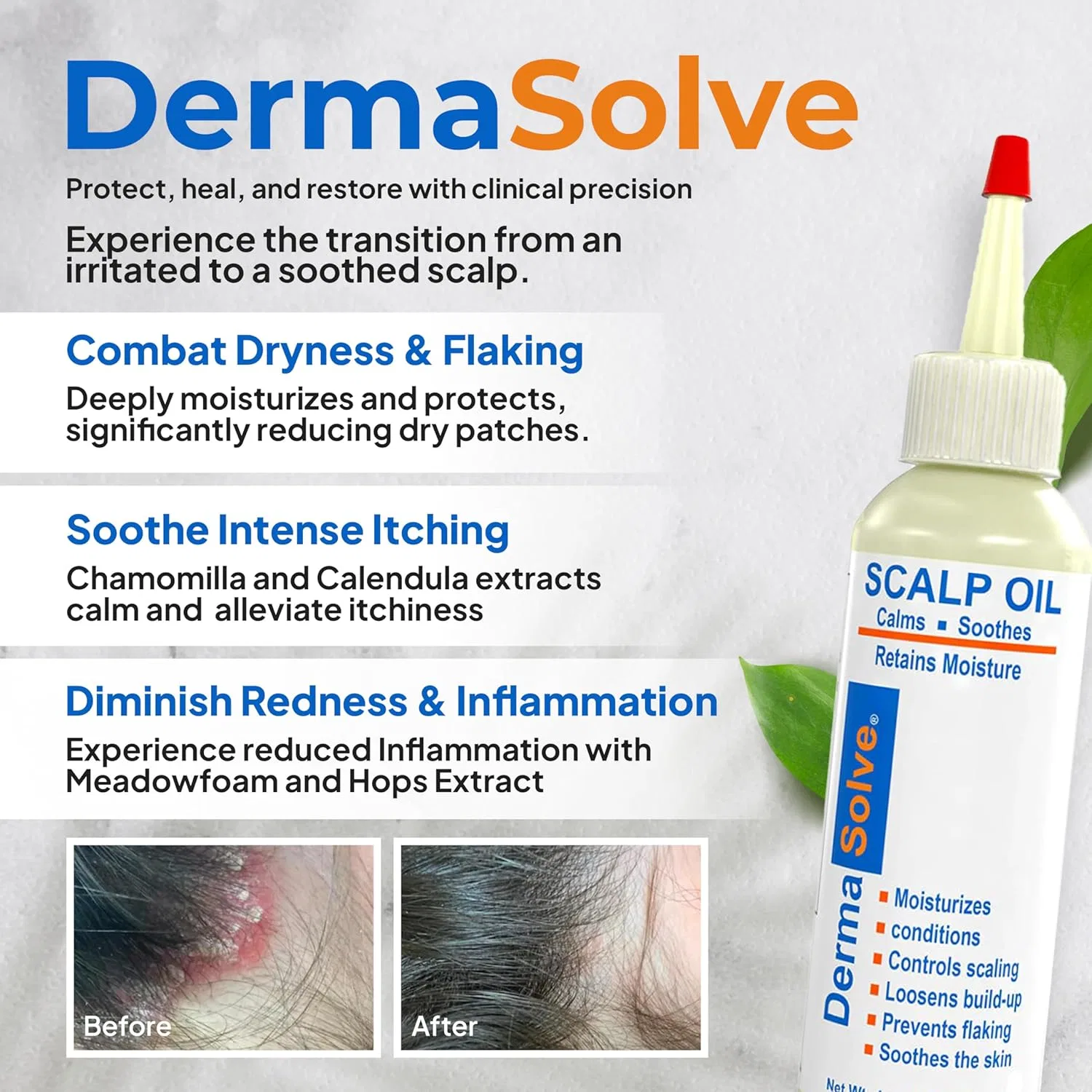 Масло для кожи головы от псориаза Dermasolve, 135 мл — фото 2