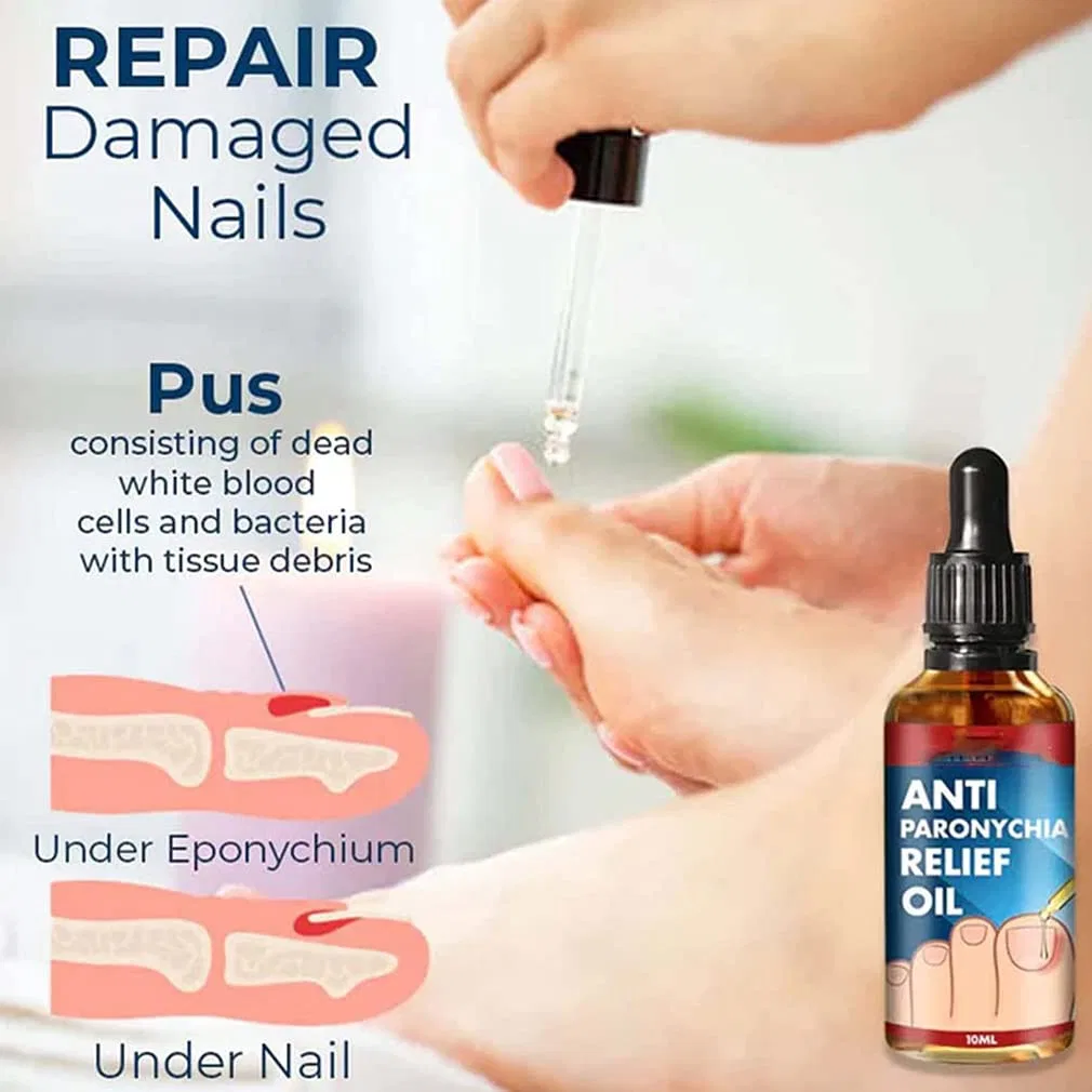 Масло для ногтей GFOUK Anti Paronychia Relief Oil, 2 шт. Zuicc — фото 3