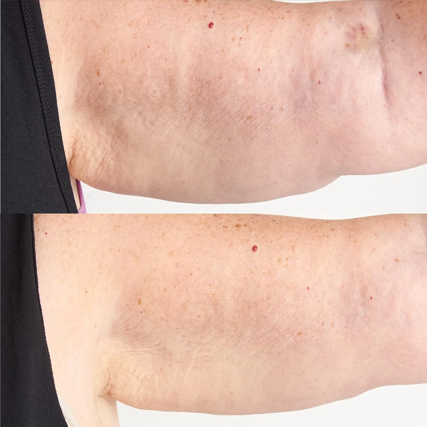 Крем для тела Perricone MD High Potency Hyaluronic Intensive Body Therapy, 177 мл — фото 3