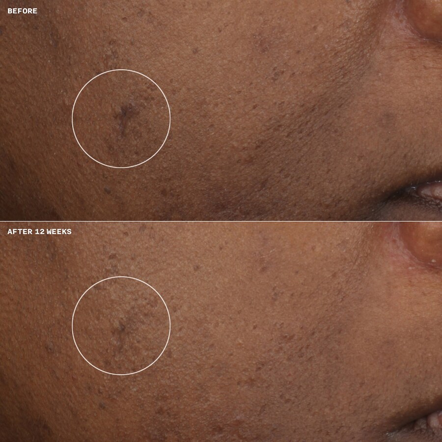 Крем для лица SPF CLINIQUE Осветляющий увлажняющий Even Better Clinical с витамином С — фото 4