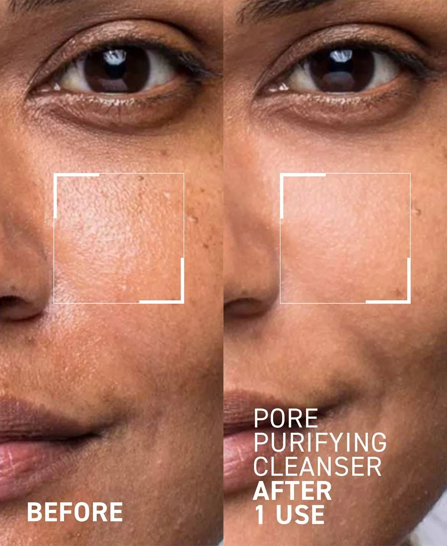 Очищающее средство для пор Pores No More, 120 мл Dr. Brandt, None — фото 3