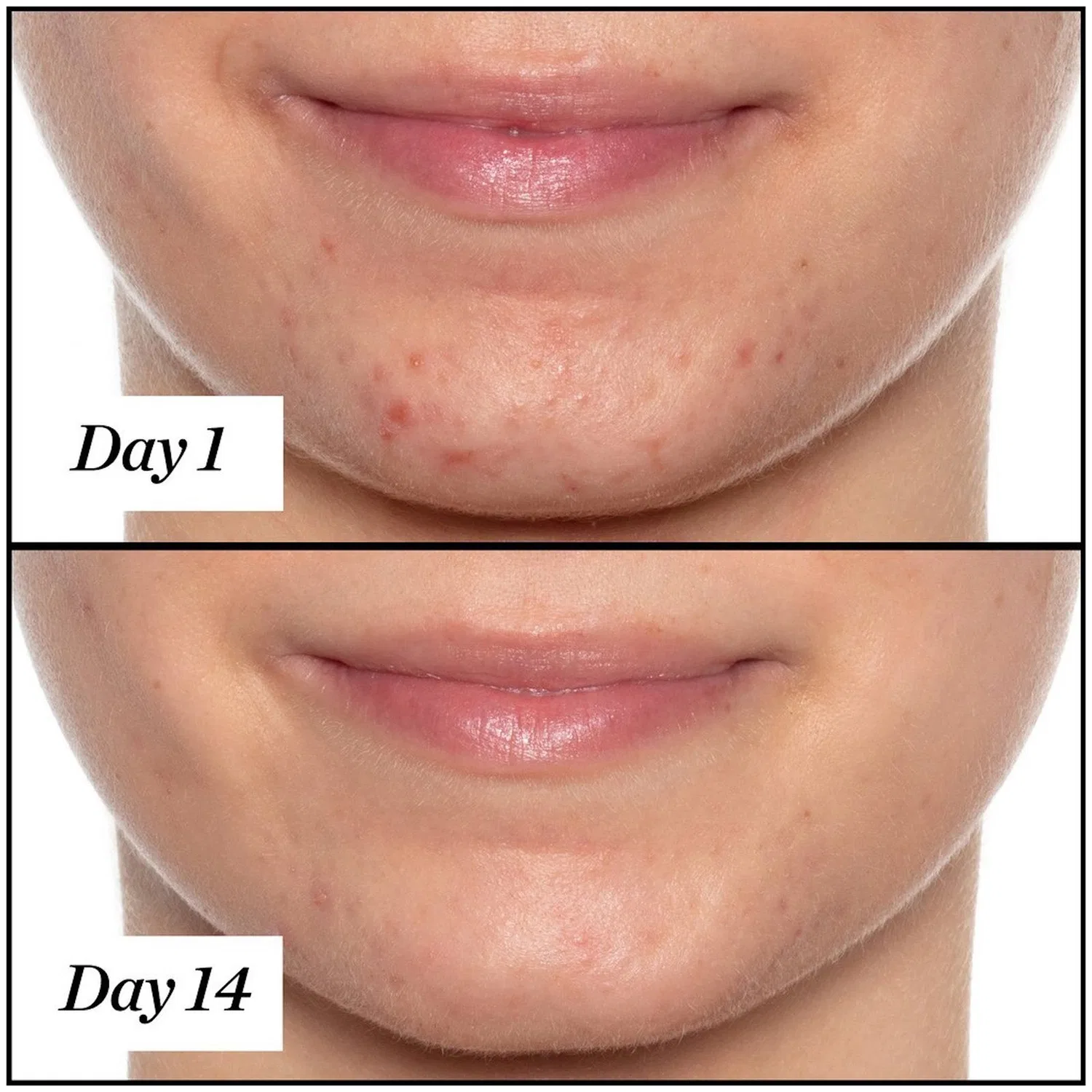 Масло для лица очищающее с салициловой кислотой U.F.O. Ultra-Clarifying Face Oil Sunday Riley, 15 мл — фото 4