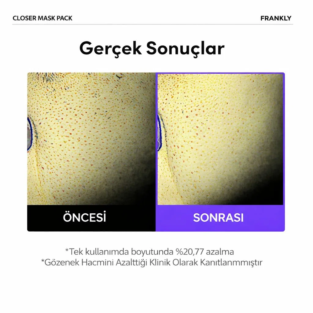 Маска для лица — «Pore Refining Face Mask» с экстрактом риса и пептидами от FRANKLY Generisch — фото 3