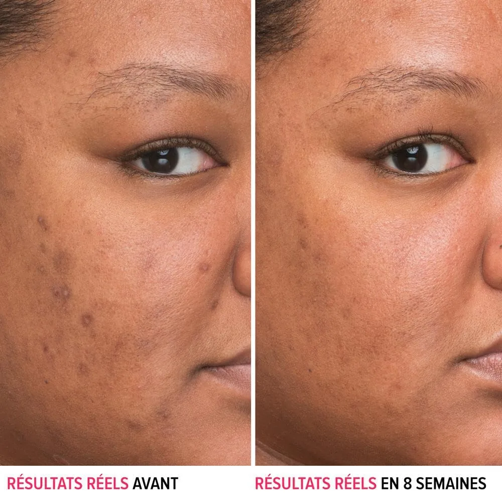 Сыворотка It Cosmetics — Bye Bye Dark Spots с % ниацинамидом - заметно уменьшает темные пятна и улучшает чистоту, 30 мл — фото 2