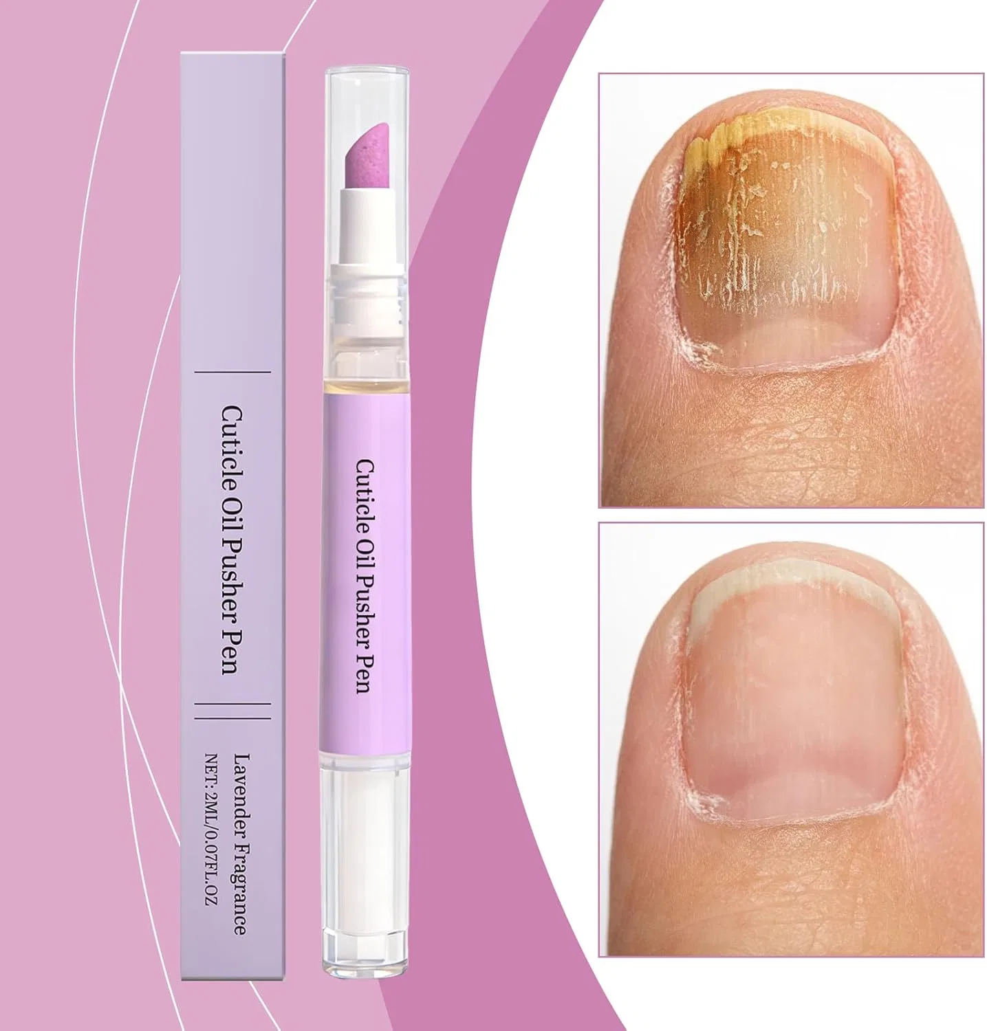Ручка для ухода за ногтями 3-в-1, удалитель кутикулы Generic, Cuticle Pusher Oil Pen — фото 3