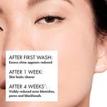 Normaderm Очищающий очищающий гель 200мл, Vichy - фото 2