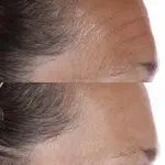 Essential Fx Ацил-глутатион Масло Чиа Perricone Md - фото 3