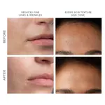 Устройство KIWI Derma Foreo - фото 6