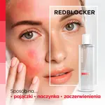 Мицеллярная жидкость Redblocker, 200 мл - фото 4