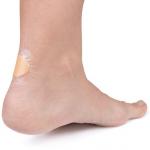 Пластыри, ссадины, клейкие мозоли, ссадины, inna - фото 3