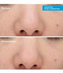 Сыворотка для лица Murad Blemish Control Targeted Pore Corrector, 15 ml - фото 2