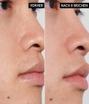 Тоник для лица The INKEY List Pha Toner, 100 ml - фото 3