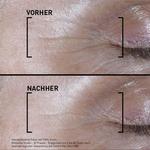 Сыворотка для лица Filorga Time-Filler Shot 5XP, 15 ml - фото 4