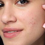 Химический эксфолиант Clear & Defense+ Neutrogena, 125 мл - фото 3