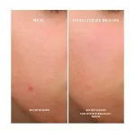 Сыворотка против прыщей Bye Bye Breakout It Cosmetics, 30 ml - фото 4