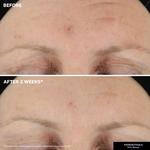 Укрепляющая сыворотка KateCeuticals Kate Somerville - фото 3