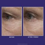 Многофункциональный крем для глаз Ultimate Solution 5 Peter Thomas Roth - фото 5