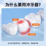 Оральные ирригаторы KONKA, Mo Bai Basic Model - 2 Gears Medium Frequency Rinse + Telescopic Water Tank - фото 6