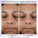 Антивозрастной крем R'nergie HPN 300-Peptide Lancôme, 2.53 oz - фото 2