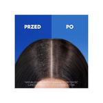 Head&Shoulders, Menthol Fresh, шампунь для волос против перхоти, 400 мл Head & Shoulders - фото 4