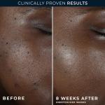 Восстанавливающий ночной крем Multi-Corexion 5-в-1 RoC - фото 4