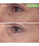 Крем для глаз Murad Resurgence Retinal Resculpt Eye Treatment, 15 ml - фото 3