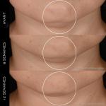 Крем для лица Rénergie HPN 300-Peptide Cream Lancôme, 50 ml - фото 3