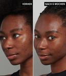 Сыворотка для лица The INKEY List Tranexamic Acid Serum, 30 ml - фото 3